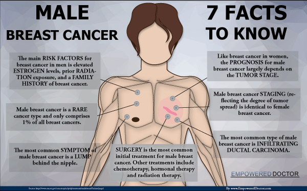 breast cancer dra martha castro tijuana baja california mexico usa