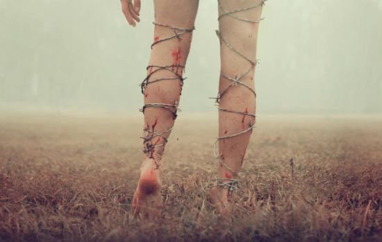 Fibromyalgia is underdiagnosed 