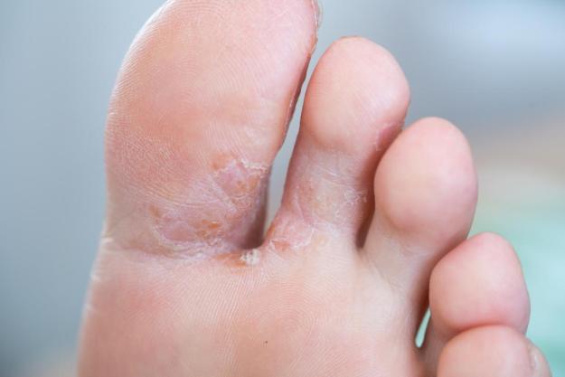 blood-sugar-diabetes-dr-martha-castro-noriega-mexico