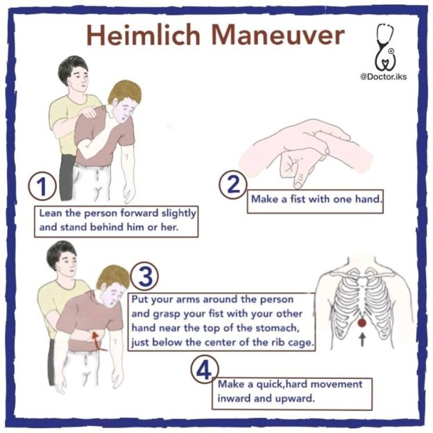 heimlich maneuver teaching saving lives dr martha castro noriega mexico