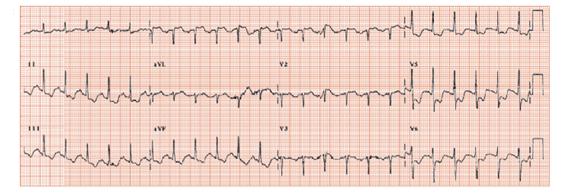 heart health cardiology medical advice dra martha castro noriega tijuana mexico california usa